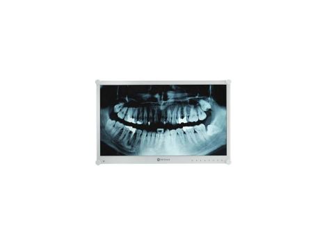 Monitor medyczny LED 24” Full HD z hartowanym szkłem optycznym, podświetlenie klisz RTG, do pracy 24/7 DR-24G